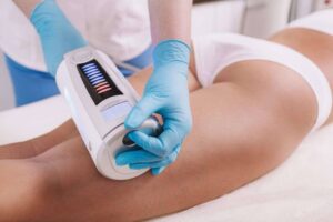 Laser Lipolysis equipment positioned on the abdomen, aimed at reducing fat and tightening the skin.