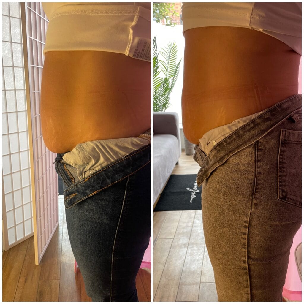 A side profile of the waist, with visible slimming results that highlight a reduction in inches around the midsection. Non-Invasive Body Sculpting